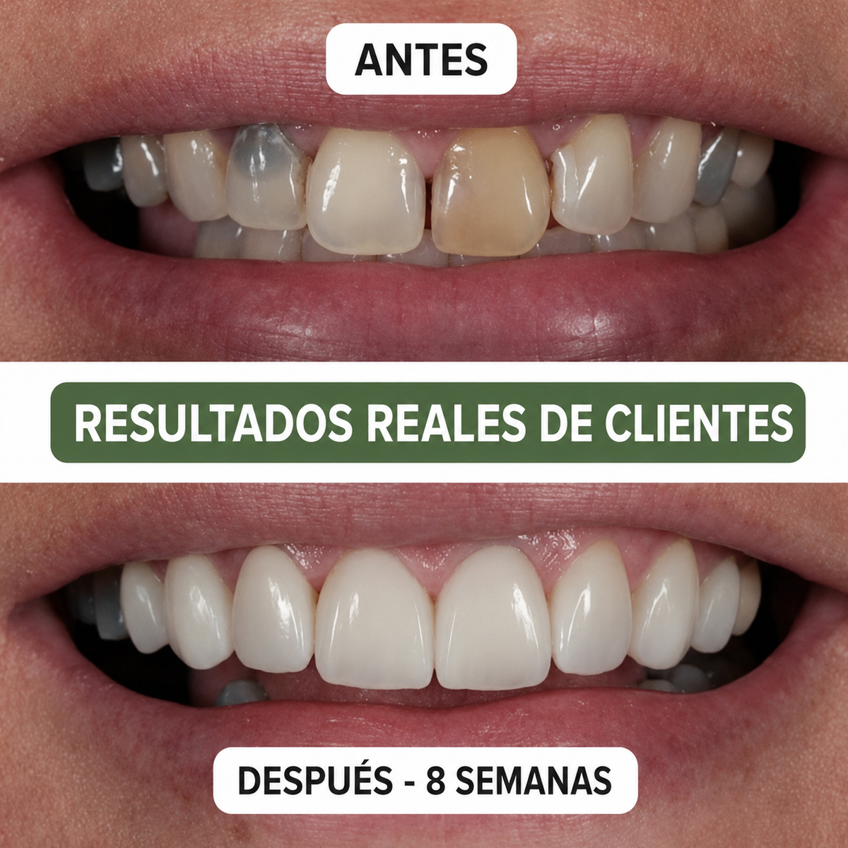 Botanis | Conservá tus dientes por más tiempo